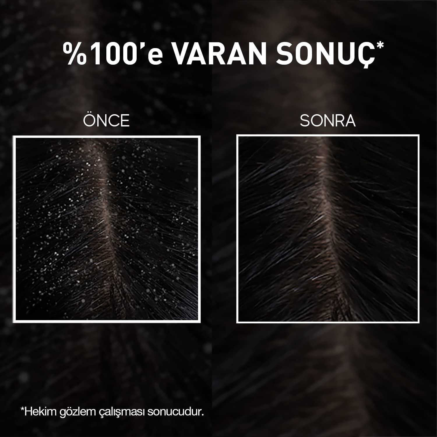 Bioxcin Aqua-Thermal Intensive Anti-Dandruff Shampoo with Probiotics & Thermal Water, 200ml