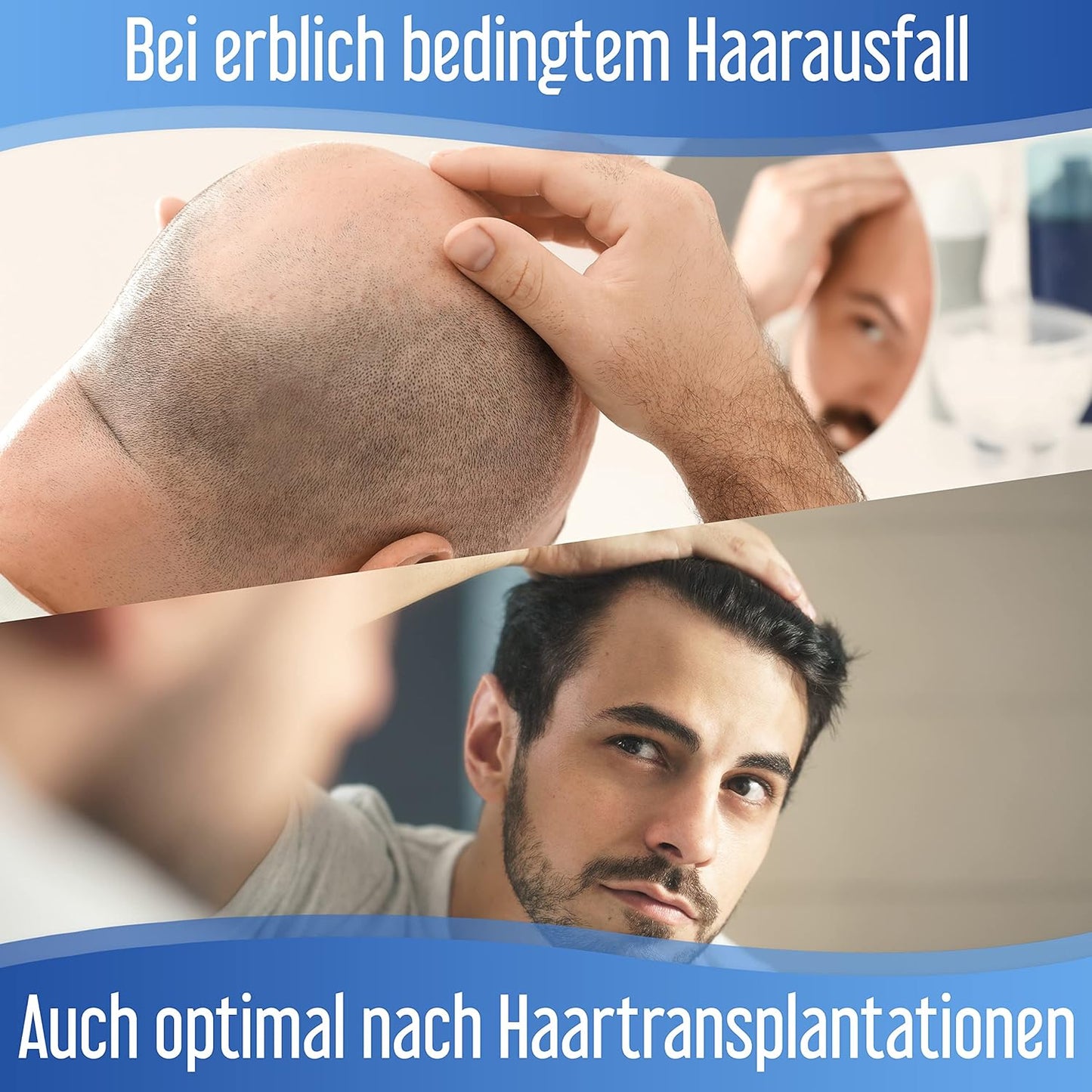 Hairforte PROCAPIL DHT Blocker Spray for Hereditary Anti-Hair Loss Treatment