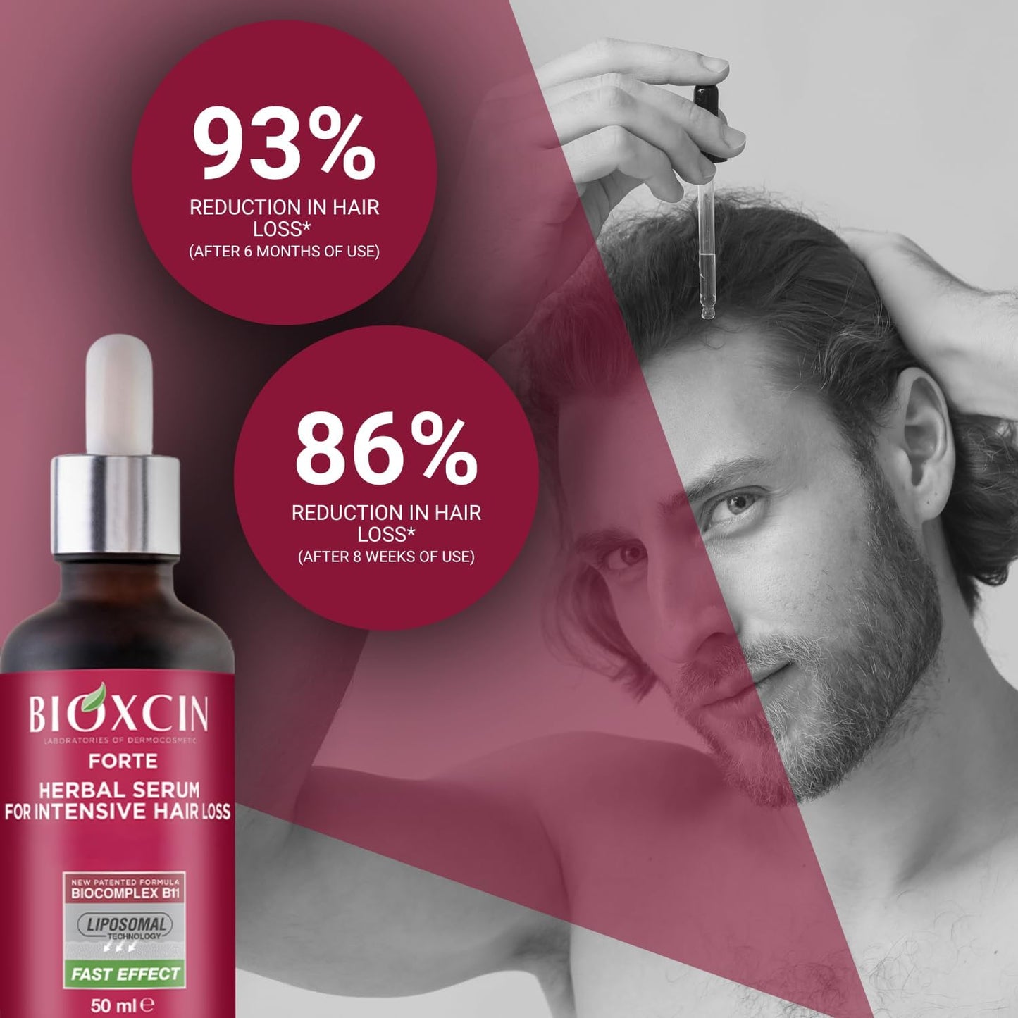 Bioxcin Forte Anti-Hair Loss Serum 3x50ml - Herbal Scalp Strengthening Treatment